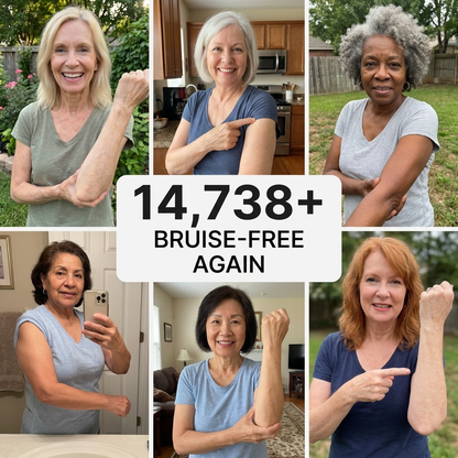 💥100K+ SOLD💕- ZURRUZ® Bruise Repair & Skin-Strengthening Cream